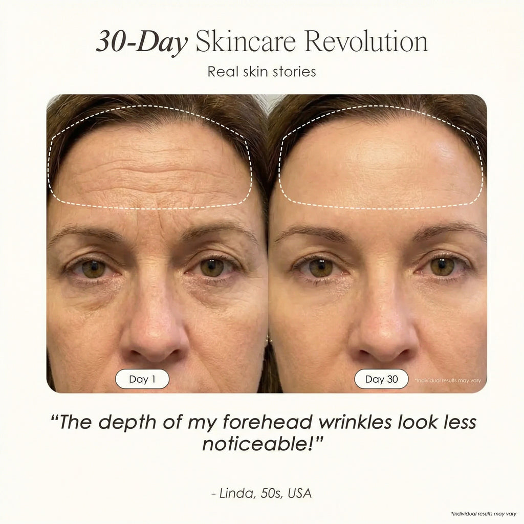 NØVAIRE PRO LED RED LIGHT THERAPY MASK