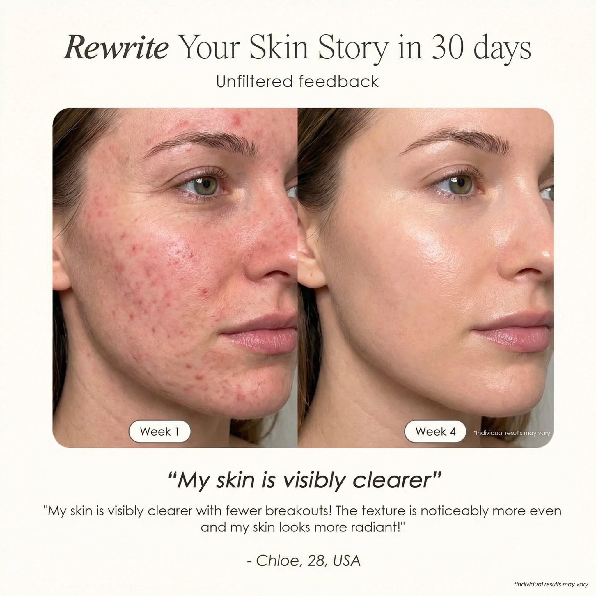 NØVAIRE PRO LED RED LIGHT THERAPY MASK